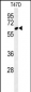 CLPB Antibody (C-term)